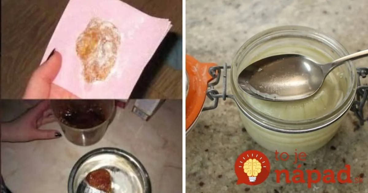 Lacné a účinné: Babské recepty proti kašľu, viróze a nachladnutiu!