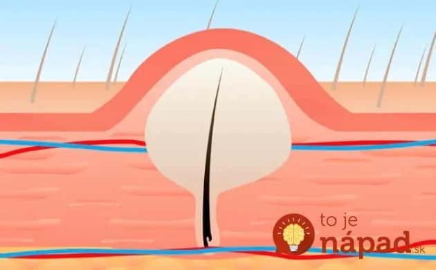 Trápia vás zarastajúce chĺpky? Geniálne triky, ako sa ich zbaviť raz a navždy!