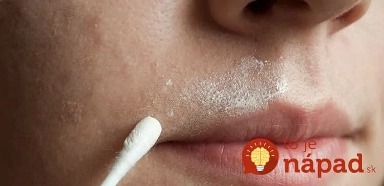 Dajte zbohom chĺpkom na tvári:  Zmiešajte tieto 3 prísady a môžete ich odstrániť natrvalo!