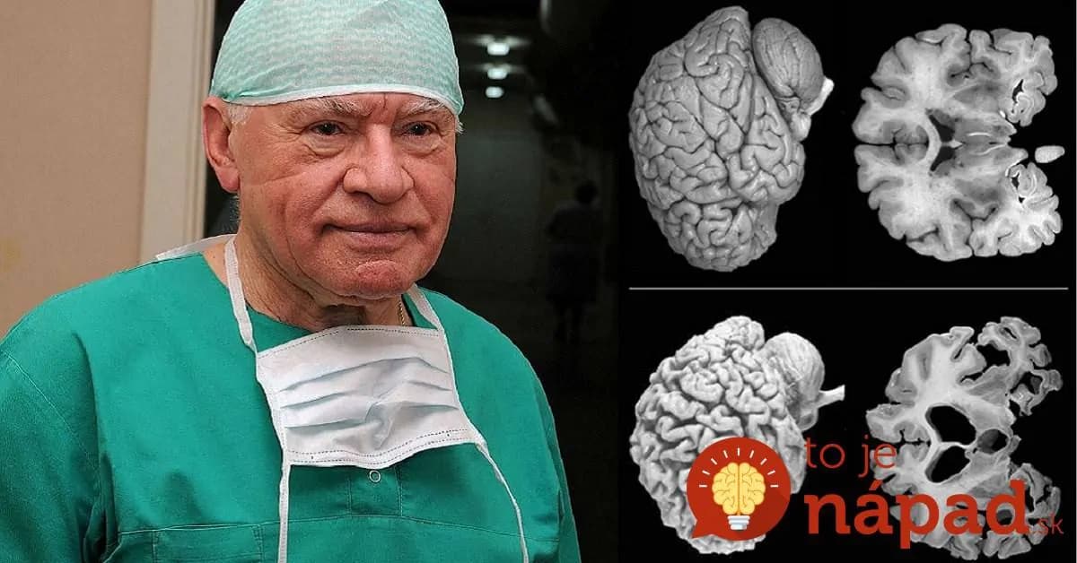 Neurochirurgovia bijú na poplach: Každá žena by mala poznať tento dôležitý fakt