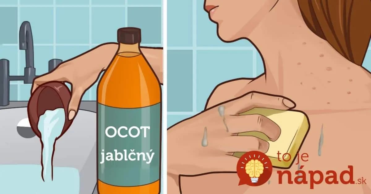 Stačia 2 minúty: Stačí priložiť jablčný ocot na tvár a jeho úžasné účinky pocítite okamžite!