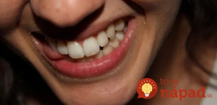 Ako odstrániť stvrdnutý zubný povlak za 2 minúty?