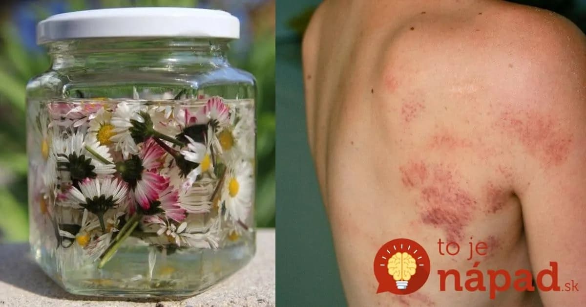 Tieto milé kvietky nám na jar rastú pod nohami: Čo však dokážu, ak ich uvaríte? Tieto účinky sa oplatí poznať!