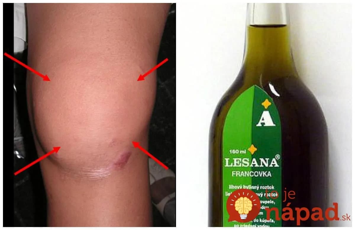 Vďaka rade od pani sestričky som sa konečne vyspala: Na reumu, boľavé kolená a výrastky to účinkuje neskutočne rýchlo!