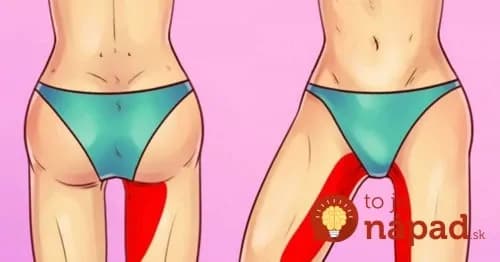 Zabudnite na beh: Ak chcete rýchlo schudnúť na stehnách a bokoch, potrebujete poznať len tieto cviky!