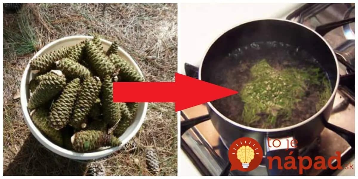 Šišky nezbierajte len na ozdobu: Stačí ich len chvíľu povariť a môžete zabudnúť na boľavé kĺby a opuchnuté nohy!