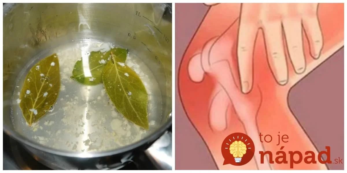 3 dni, nestojí to nič a výsledok si nebudete vedieť vynachváliť: Záchrana pre kosti, kĺby a konečne úľava od bolesti!