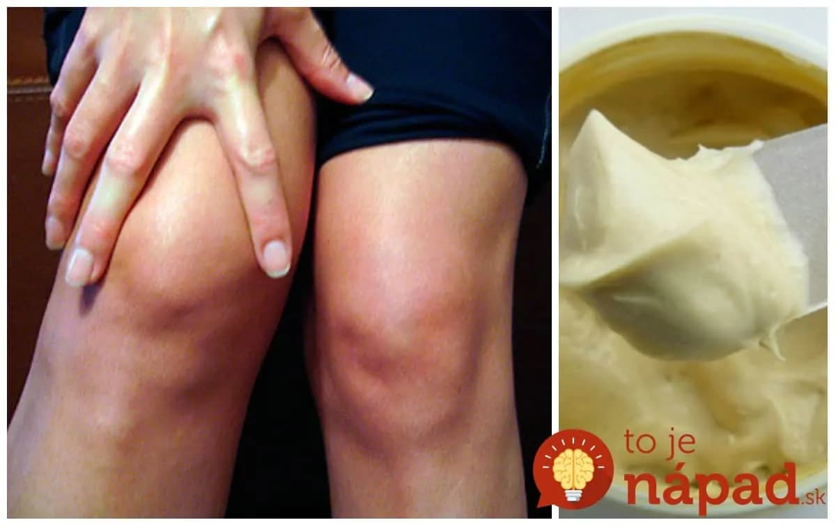 Túto zázračnú masť na kolená mi poradila mama – uľavilo sa mi už prvom použití: Stačí večer natrieť a konečne sa dobre vyspíte, žiadna bolesť!