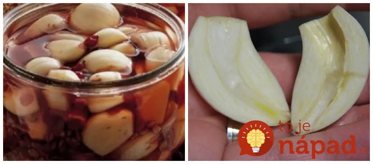 Nezaberajú vám sirupy z lekárne? Vyskúšajte cesnakový zázrak – zatočí s chrípkou, vyčistí cievy a pomôže vám schudnúť!