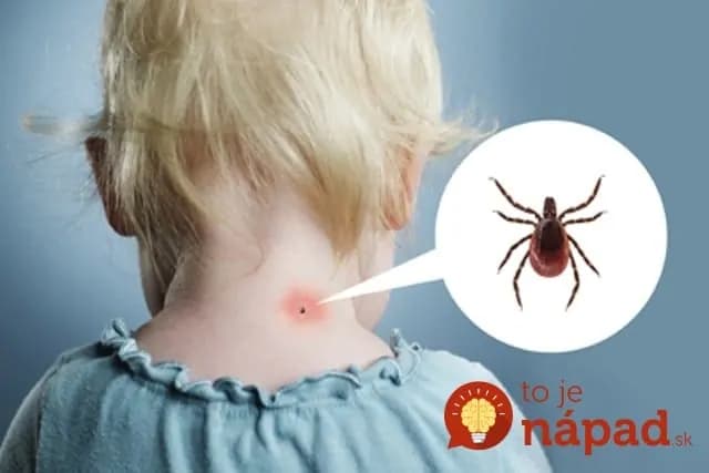 Ako sa zbaviť nenávidenej hávede pomocou soli: Toto by mal počas sezóny vedieť každý!