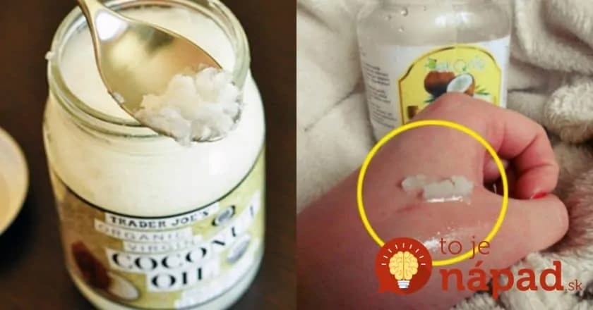 Toto sa na obale nedočítate: Kokosový olej vylieči boľavé hrdlo a pomôže kostiam – 29 úžasných využití, o ktorých mnohí ľudia vôbec netušia!