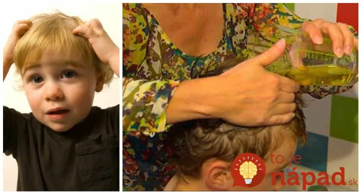 Netreba drahé olejčeky ani šampón z lekárne: Toto zničilo vši po prvom použití, je to čistá príroda!