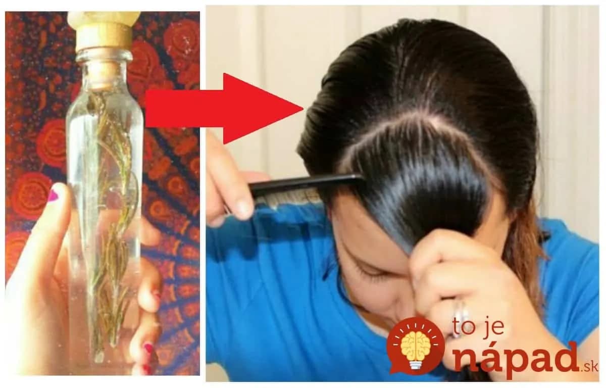 Keď potrebovali naše babičky zastaviť padanie vlasov, vždy stavili na túto vodu: Je neskutočné, čo dokáže s hrivou už za mesiac!