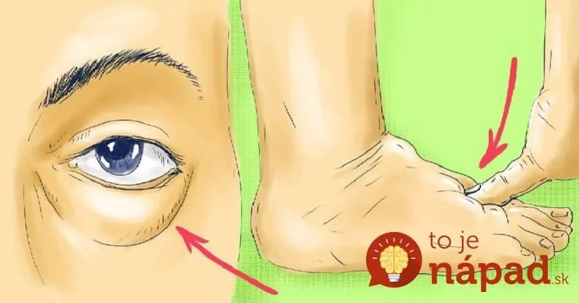 Zbohom vačky pod očami a opuchnuté nohy: Tento nápoj mi poradili na chudnutie, tento účinok je však ešte omnoho lepší!