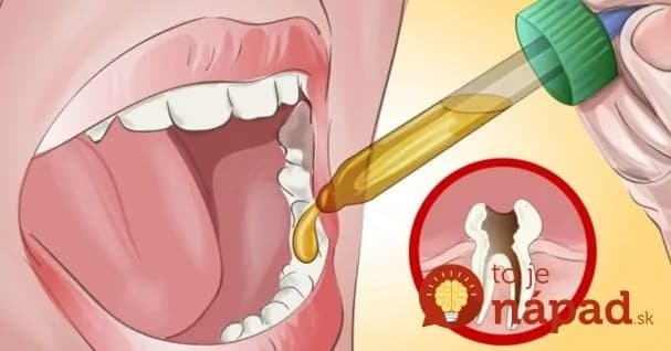Starý trik našich babičiek ako zatočiť s bolesťou zubov: Netreba čakať celé hodiny, funguje to hneď!