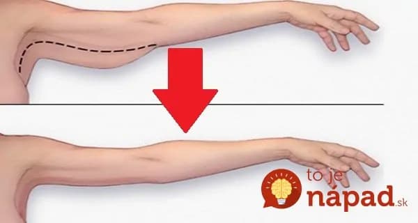 Dámy, zabudnite na činky: Ak chcete rýchlo spevniť ochabnuté paže, potrebujete poznať len tieto cviky!