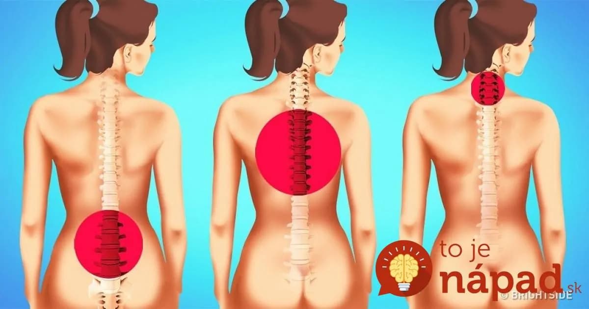 1 minúta zatočí s bolesťou chrbtice: Každý, koho bolí chrbtica by sa mal naučiť túto metódu – funguje najrýchlejšie!
