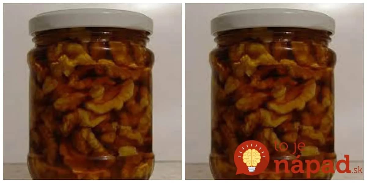 TOTO poraďte každému, kto má orechy – perfektná pomoc: Takto vám vydržia čerstvé roky + tip, s ktorým budú extra liečivé!