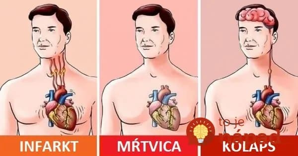 Toto by si mal zapísať za uši každý: Pomôcka, ako podať prvú pomoc, ako skúsený záchranár – to by mali učiť v každej škole!