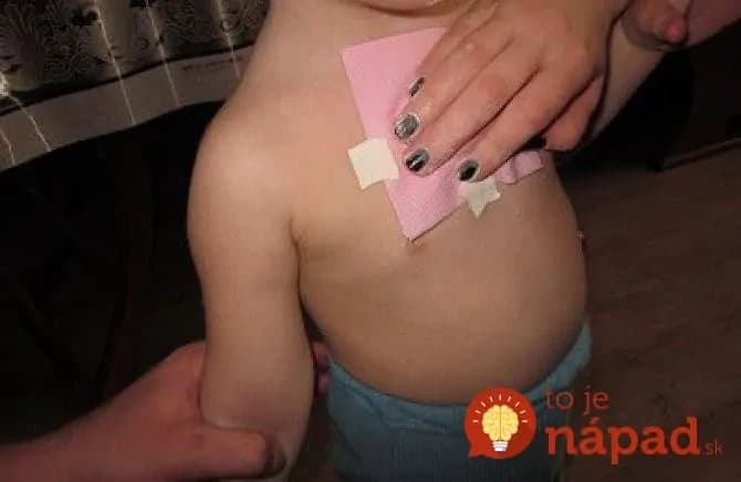 Veľmi efektívny medový zábal pre deti- lieči kašeľ a odstraňuje hlien z priedušiek: Toto dá kašeľ do poriadku, kým drobec spí!