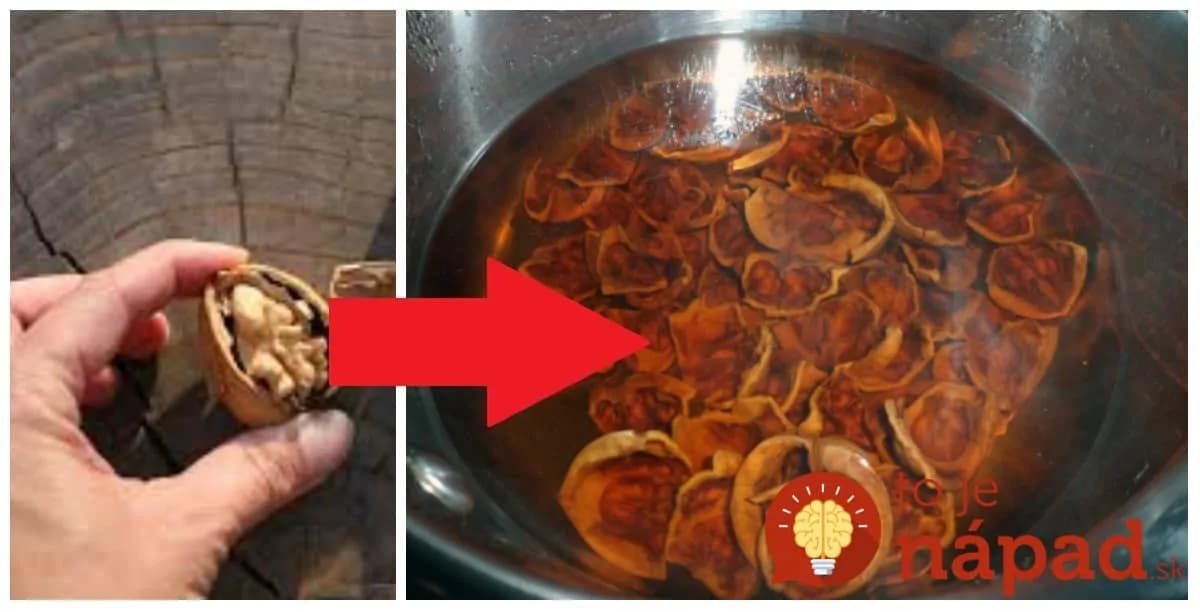 Úžasné účinky orechových škrupín ktoré by mal (nielen) v týchto dňoch poznať úplne každý!
