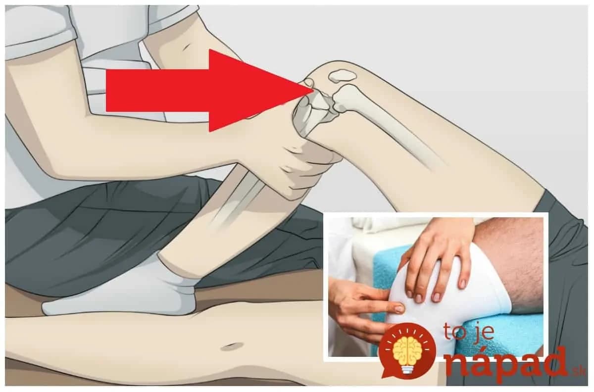 Toto povedzte každému, koho trápia kolená: Overené, odskúšané – stokrát lepšie, ako hltať drahé prípravky proti bolesti!