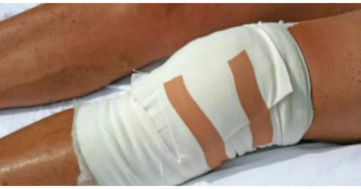 Trápi vás opuch a bolesť kolien? Skúste tento domáci OBKLAD – zmenu cítite okamžite!