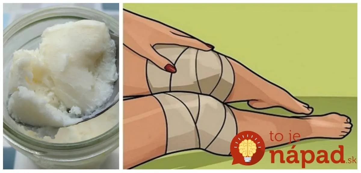 Dedo ma naučil, ako zatočiť s bolesťou kolien bez drahých liekov proti bolesti: Radím to každému, komu bolesť strpčuje život!