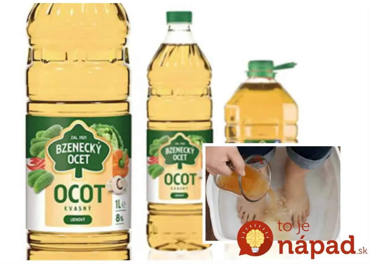 Zázrak za pár centov: Obyčajný ocot vás ochráni nielen pred predčasným starnutím, ale aj pred bolesťou kĺbov – toto sa oplatí vedieť!