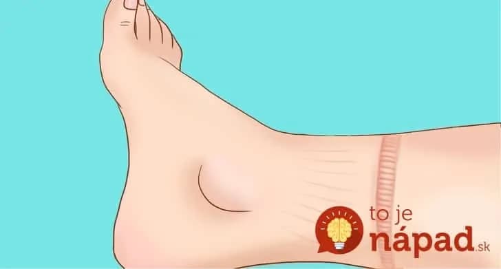 Toto vraj doslova vytiahne zadržiavanú vodu z vášho tela a kilá pôdu dole: 10 potravín, ktoré po 50-kte dajú do poriadku postavu a pomôžu aj zdraviu!