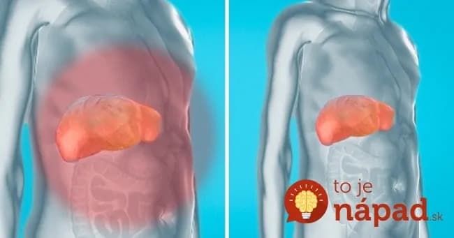 Najjednoduchší spôsob, ako vyčistiť pečeň a zbaviť telo toxínov za 7 dní: Je to sila a oproti liekom nestojí nič!