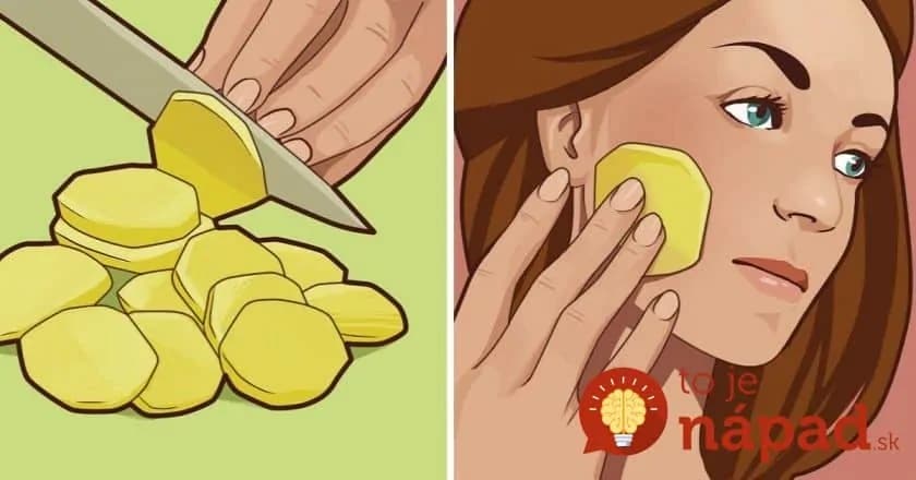 Pretrite si každý deň tvár s plátkom obyčajného zemiaku a ten rozdiel si všimne aj vaše okolie: Účinok, ktorý by mali poznať hlavne ženy!