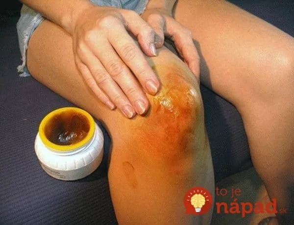 Toto by mal poznať každý, komu sa začínajú ozývať kĺby: Odložte ružové tablety na bolesť, tento starý recept má nevídaný účinok!