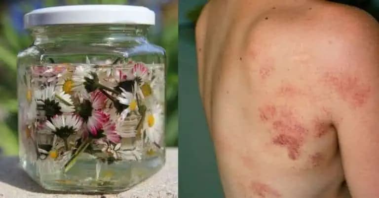 Tieto milé kvietky nám na jar rastú pod nohami: Čo však dokážu, ak ich uvaríte? Tieto účinky sa oplatí poznať!