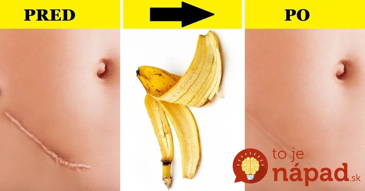 Dokáže neuveriteľné veci: Tieto ženy používajú obyčajnú banánovú šupku spôsobom, o akom sa nám ani nesnívalo – skúste to tiež!