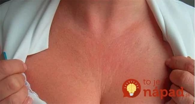 Kozmetička to radí všetkým dámam po 40-tke: Ak vás trápia vrásky na dekolte, toto ich zmierni a krk omladí aspoň o 7 rokov!