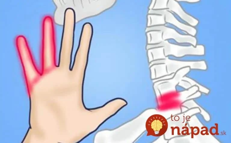 Toto by mal vidieť každý, komu tŕpnu ruky a bolesť vystreľuje až do chrbta: 5 pohybov, ktoré vám pomôžu okamžite!