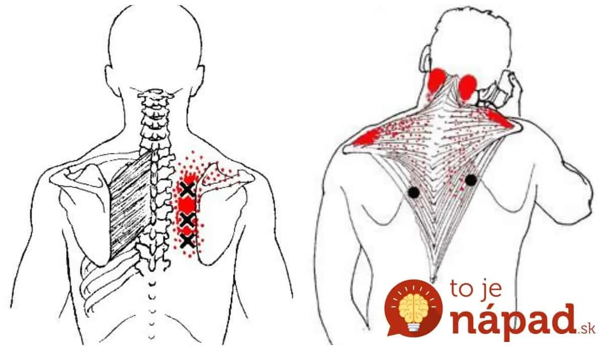 Záchrana pre každého, koho bolí medzi lopatkami a bolesť strieľa do celého tela: 1 pohyb pomáha okamžite!