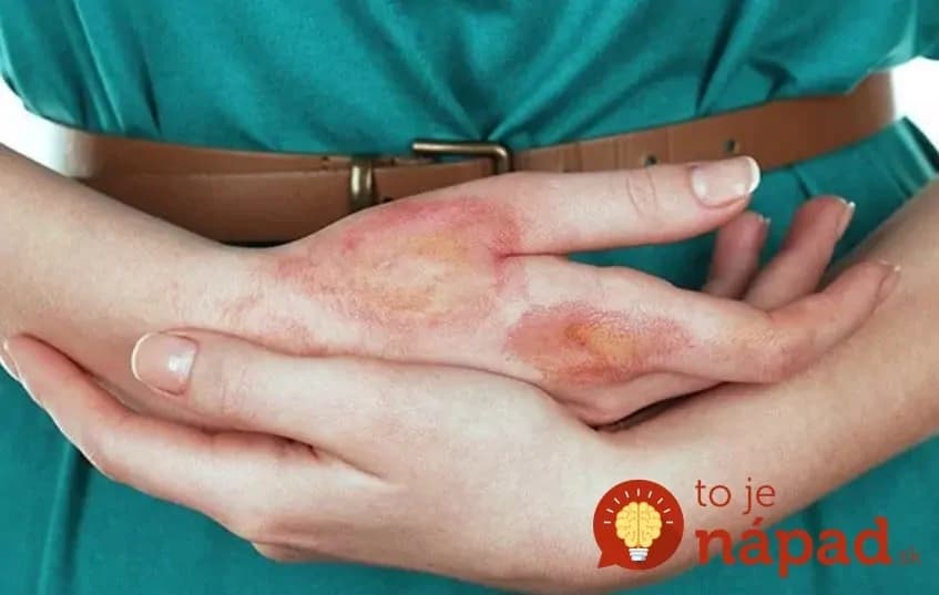 Kurkuma dokáže zázraky: Skúste si dať štipku každý deň a na týchto 14 problémov zabudnete!