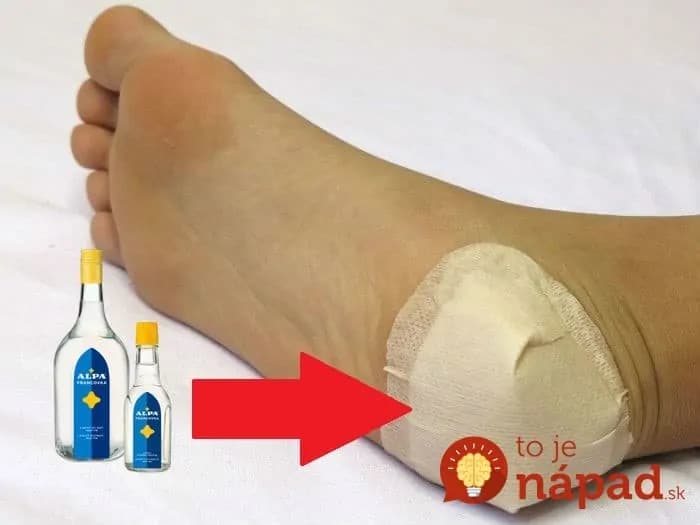 Stačí pár dní a máte nohy ako bábätko: Stvrdnutú kožu a otlaky na nohách už neriešim, toto funguje či je leto alebo zima!
