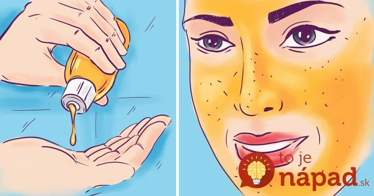 Zázračná maska na tvár proti pigmentovým škvrnám a vyrážkam: Zmiešajte 2 prísady a výsledok schová do vrecka aj drahé krémy z obchodu!