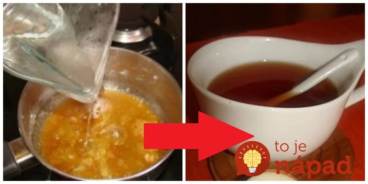 Jediný liek na kašeľ a zapálené priedušky, ktorý deti pýtajú, aj keď sú zdravé: Zázračný karamelový čaj – zaberie za 1 deň!