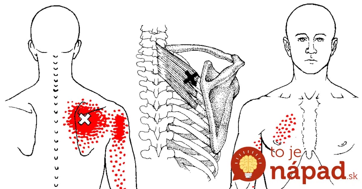 Český terapeut ukázal zázračný spôsob, ako zastaviť bolesť medzi lopatkami za pár minút: Budete sa cítiť ako znovuzrodení!