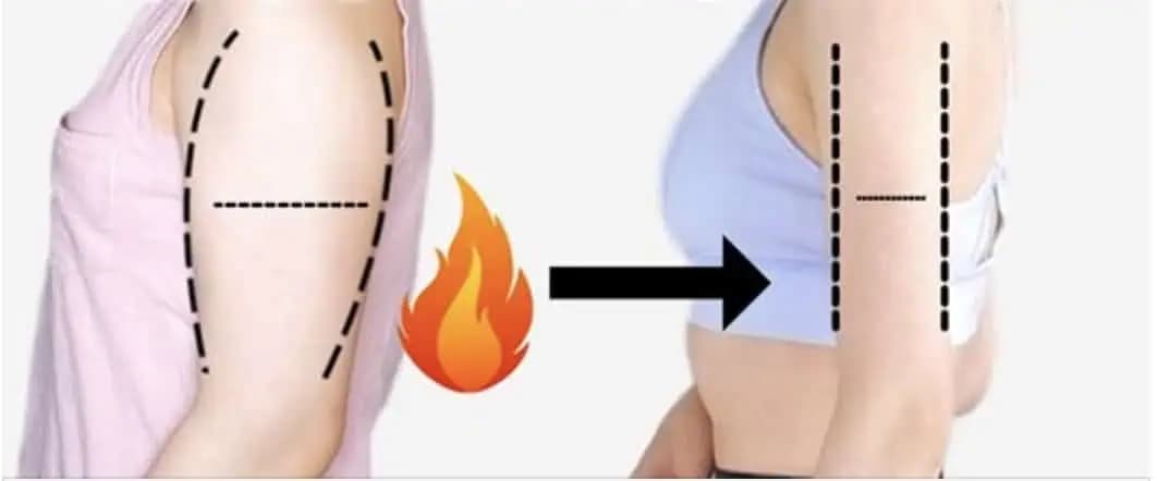 Netreba drahú plastiku, toto funguje rýchlo: 7 top cvikov pre štíhle a pevné paže!