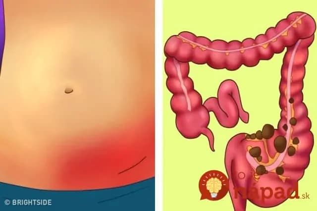 Po 50-tke dajú do poriadku to, čo ste celé roky kazili: 10 potravín, ktoré vyplavia kilogramy, zlikvidujú choroby a pomôžu kĺbom!