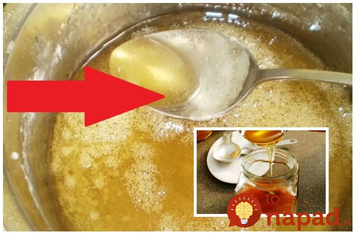 Zaručený prírodný zázrak aj na škaredý kašeľ: Stačil 1 deň a bolo po kašli, odporúčam každému, kto nechce kupovať drahé sirupy z lekárne!