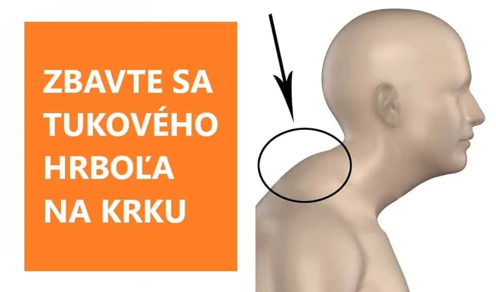 Problémy s krčnou chrbticou: Toto cvičenie narovná vysunutý krk a zbaví vás tukového hrboľa!