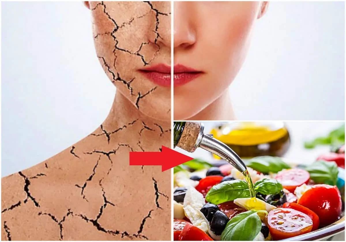 Zoznam zázračných potravín, ktoré vám pomôžu s psoriázou a dokážu zlepšiť stav vašej pokožky!