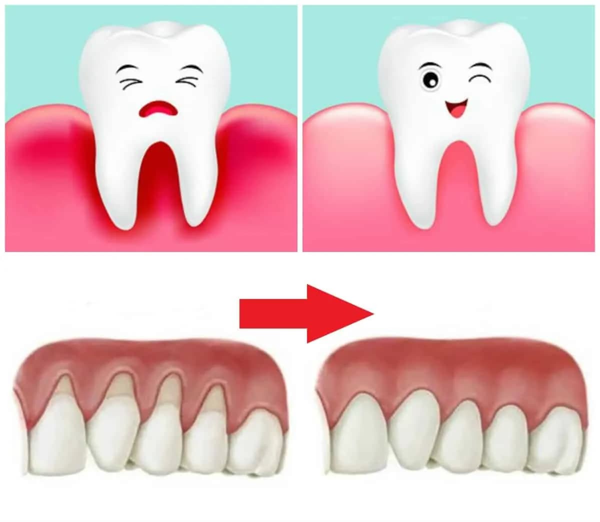 Zdravé ďasná aj po 40-tke: Vďaka týmto radám sa vyhnete problému s ustupujúcimi ďasnami!
