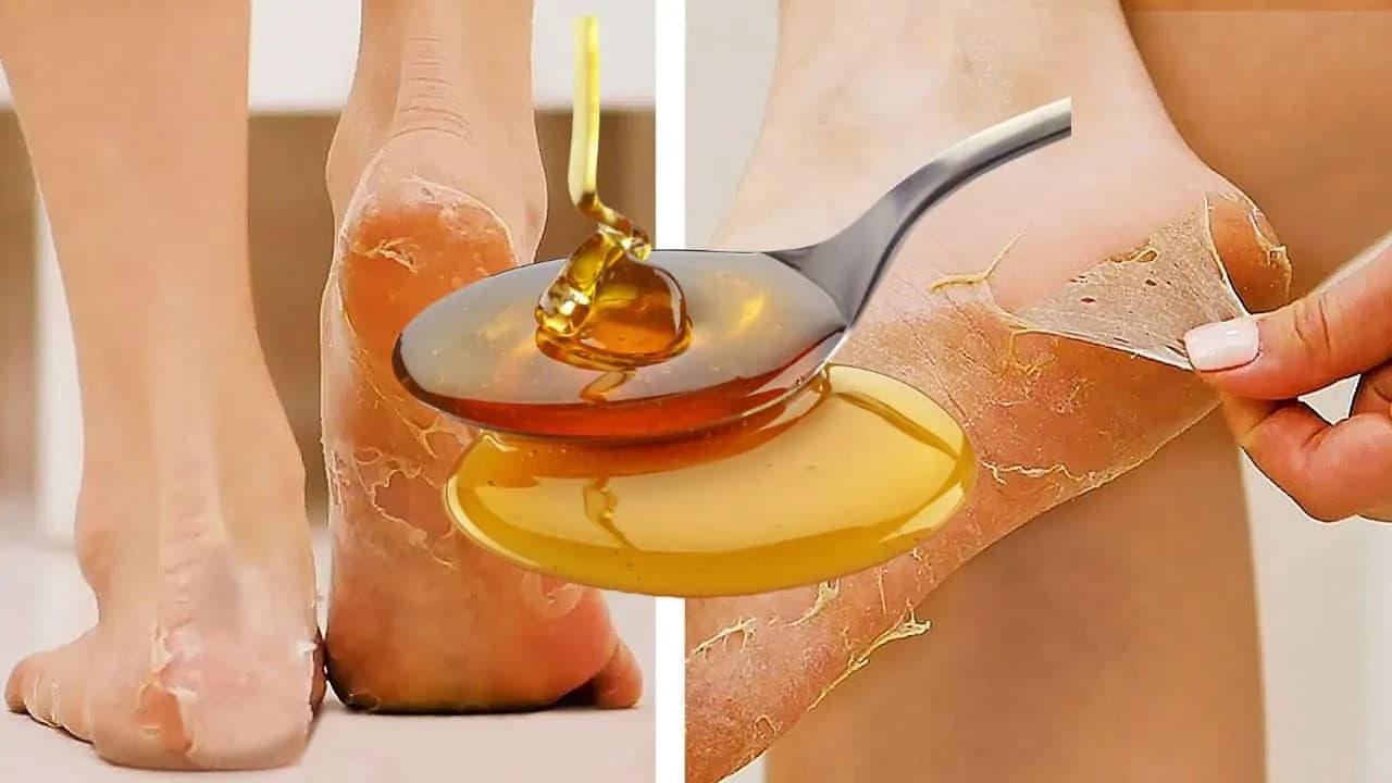 Takýto zázrak dokáže obyčajný med, ak si ho dáte na pokožku: Kto pozná ten účinok, ušetrí stovky eur na kozmetike!